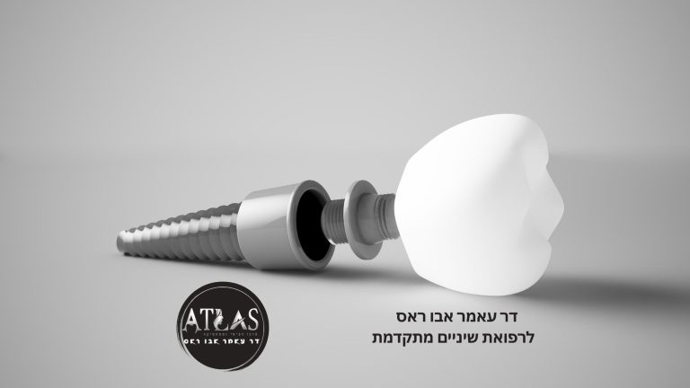 השתלות שיניים מתקדמות – MIS ו-STRAUMANN