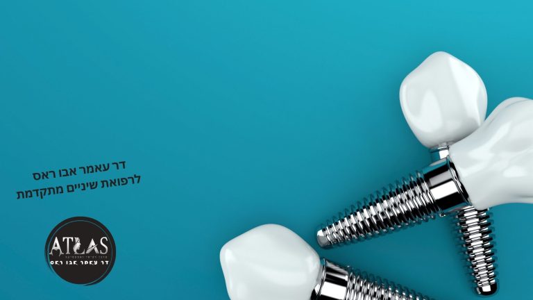 השתלת שיניים ביום אחד